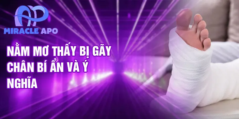 Nằm mơ thấy bị gãy chân bí ẩn và ý nghĩa